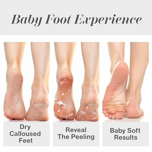 Three stages of a foot peeling treatment: dry calloused feet, peeling process, baby soft results.